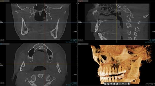 cbct.jpg