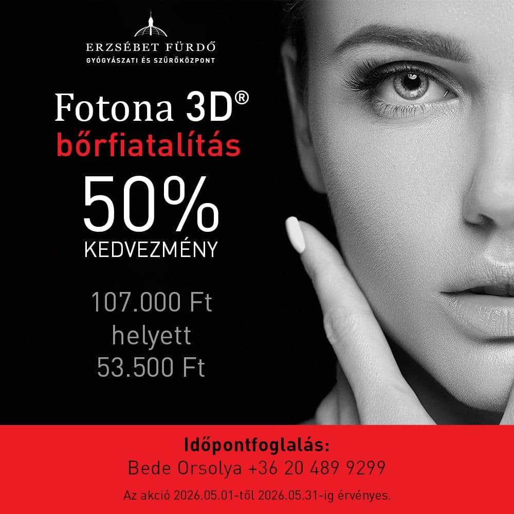 fotona_3d.jpg