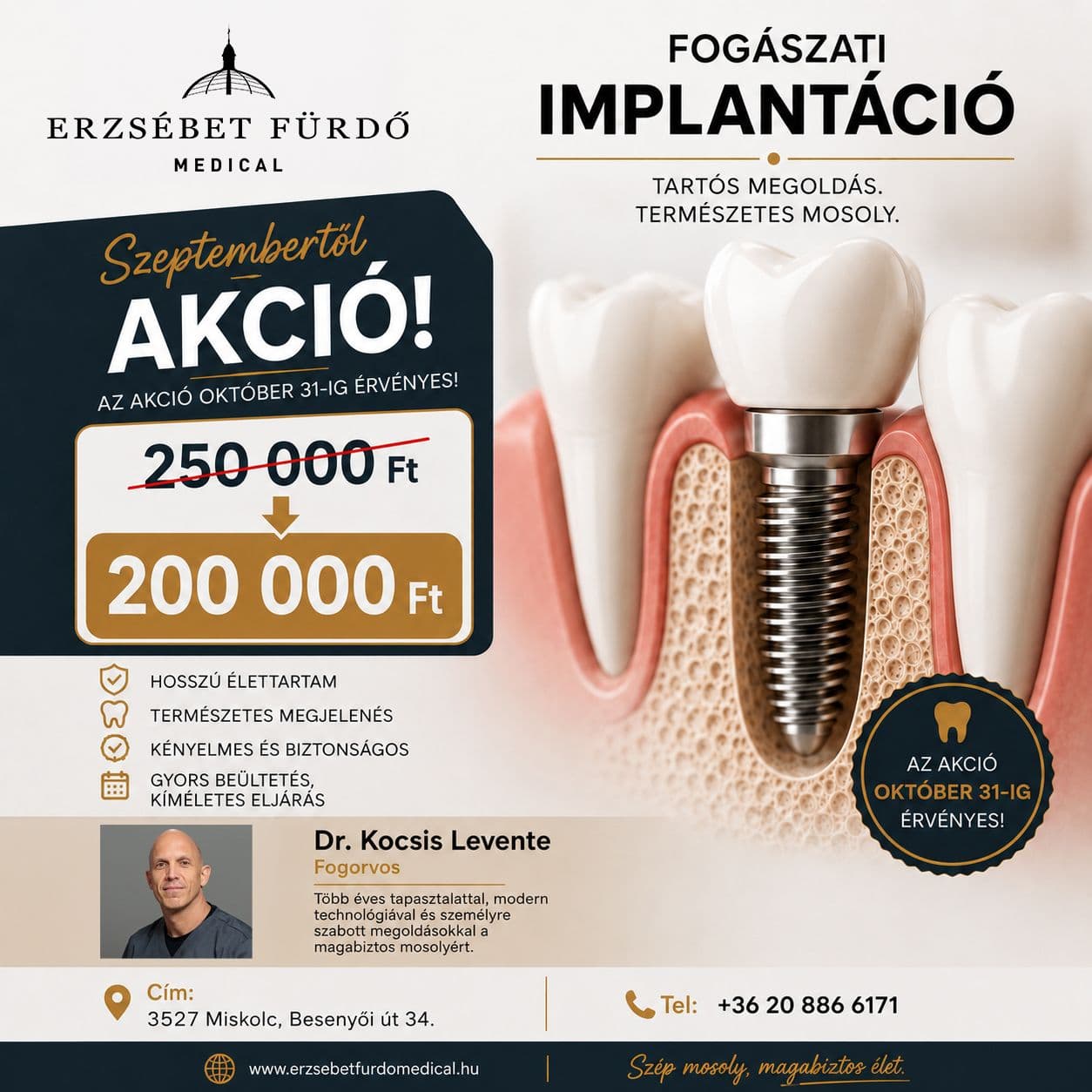 implant-akcio.jpg